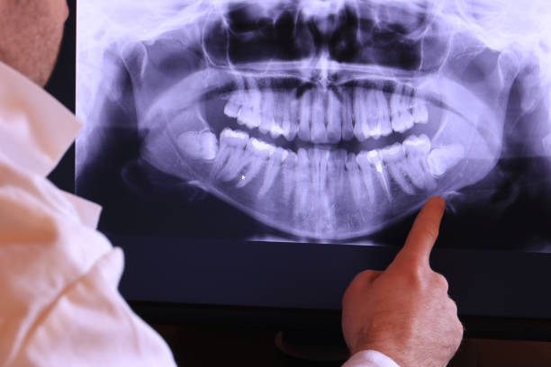 Best Walk-In Emergency Dentist in South Waverly, PA